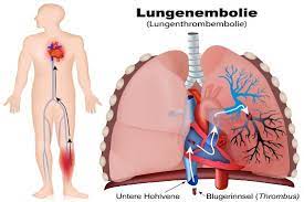 herz- und lungengesundheitsberatung